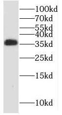 Western Blot: PPP2CB Antibody - BSA Free [NBP3-46913] - Mouse lung tissue were subjected to SDS PAGE followed by western blot with (PPP2CB antibody) at dilution of 1:400