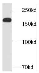 Western Blot Neurabin 1 Antibody - BSA Free