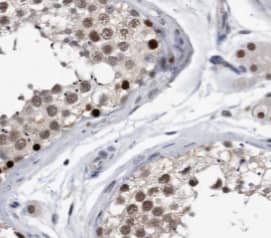 Immunohistochemistry: PPP1R2P9 Antibody - BSA Free [NBP3-46917] - Immunohistochemistry of paraffin-embedded human testis using (PPP1R2P9 antibody) at dilution of 1:50