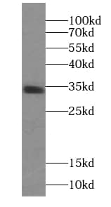 Western Blot: PPP1R2P9 Antibody - BSA Free [NBP3-46917] - Human testis tissue were subjected to SDS PAGE followed by western blot with (PPP1R2P9 antibody) at dilution of 1:300