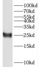 Western Blot: PPP1R14D/GBPI-1 Antibody - BSA Free [NBP3-46919] - Mouse colon tissue were subjected to SDS PAGE followed by western blot with ( PPP1R14D/GBPI-1 Antibody) at dilution of 1:1000