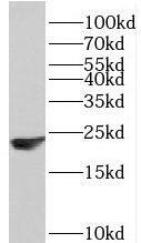 Western Blot: PPP1R14B Antibody - BSA Free [NBP3-46920] - MCF-7 cells were subjected to SDS PAGE followed by western blot with (PPP1R14B antibody) at dilution of 1:300