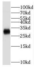 Western Blot: PPM1M Antibody - BSA Free [NBP3-46921] - Human lung tissue were subjected to SDS PAGE followed by western blot with (PPM1M antibody) at dilution of 1:500
