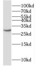 Western Blot: PPIL6 Antibody - BSA Free [NBP3-46923] - HeLa cells were subjected to SDS PAGE followed by western blot with (PPIL6 antibody) at dilution of 1:500