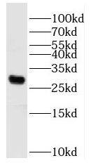 Western Blot: PPAPDC3 Antibody - BSA Free [NBP3-46925] - Mouse skeletal muscle tissue were subjected to SDS PAGE followed by western blot with (PPAPDC3 antibody) at dilution of 1:800