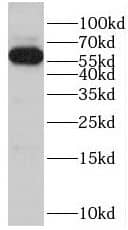 Western Blot: POTEH Antibody - BSA Free [NBP3-46929] - DU 145 cells were subjected to SDS PAGE followed by western blot with ( POTEH Antibody) at dilution of 1:300