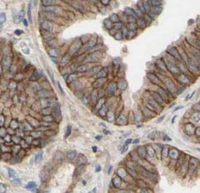 Immunohistochemistry POTED Antibody - BSA Free