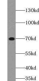 Western Blot: POTED Antibody - BSA Free [NBP3-46930] - Ramos cells were subjected to SDS PAGE followed by western blot with (POTED antibody) at dilution of 1:1000