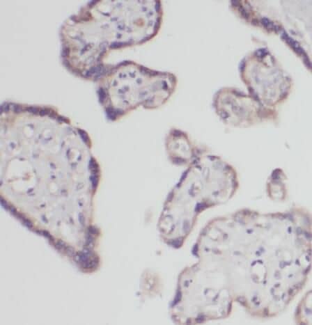 Immunohistochemistry POPDC3 Antibody - BSA Free