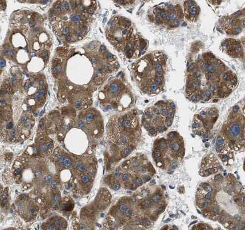 Immunohistochemistry: HSPC014 Antibody - BSA Free [NBP3-46936] - Immunohistochemistry of paraffin-embedded human liver tissue slide using (HSPC014 Antibody) at dilution of 1:50