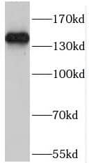 Western Blot POM121 Antibody - BSA Free