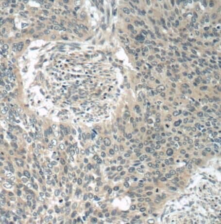 Immunohistochemistry POM121 Antibody - BSA Free
