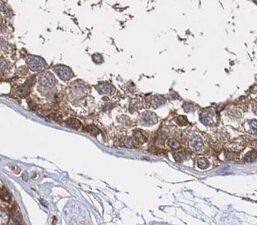Immunohistochemistry Nanos3 Antibody - BSA Free