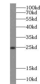 Western Blot: Nanos3 Antibody - BSA Free [NBP3-46948] - Mouse testis tissue were subjected to SDS PAGE followed by western blot with (Nanos3 antibody) at dilution of 1:300