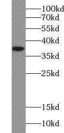 Western Blot N-Acetyl-D-Glucosamine Kinase/NAGK Antibody - BSA Free