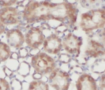 Immunohistochemistry: N-Acetyl-D-Glucosamine Kinase/NAGK Antibody - BSA Free [NBP3-46950] - Immunohistochemistry of paraffin-embedded human kidney tissue slide using (N-Acetyl-D-Glucosamine Kinase/NAGK antibody) at dilution of 1:200