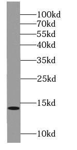 Western Blot: SSNA1 Antibody - BSA Free [NBP3-46951] - Mouse testis tissue were subjected to SDS PAGE followed by western blot with (SSNA1 antibody) at dilution of 1:400