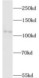 Western Blot: MYT1L Antibody - BSA Free [NBP3-46955] - HepG2 cells were subjected to SDS PAGE followed by western blot with ( MYT1L Antibody) at dilution of 1:600