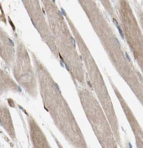 Immunohistochemistry MYPN Antibody - BSA Free