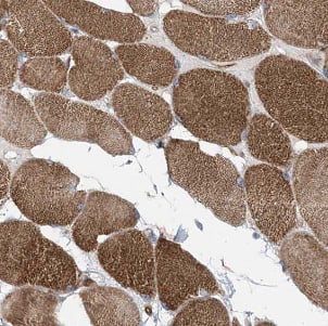 Immunohistochemistry myozenin 3 Antibody - BSA Free