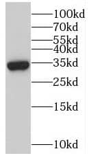 Western Blot myozenin 3 Antibody - BSA Free