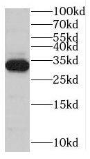 Western Blot: Myozenin 1 Antibody - BSA Free [NBP3-46959] - Mouse skeletal muscle tissue were subjected to SDS PAGE followed by western blot with ( Myozenin 1 Antibody) at dilution of 1:600