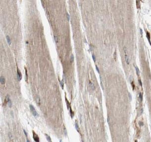 Immunohistochemistry: MYOM1 Antibody - BSA Free [NBP3-46962] - Immunohistochemistry of paraffin-embedded human skeletal muscle tissue slide using (MYOM1 Antibody) at dilution of 1:50