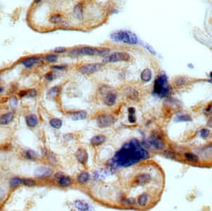 Immunohistochemistry: Myoferlin Antibody - BSA Free [NBP3-46963] - Immunohistochemistry of paraffin-embedded human placenta using (Myoferlin antibody) at dilution of 1:100