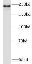 Western Blot: Myoferlin Antibody - BSA Free [NBP3-46963] - A549 cells were subjected to SDS PAGE followed by western blot with (Myoferlin antibody) at dilution of 1:300
