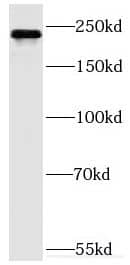 Western Blot MYO9B Antibody - BSA Free