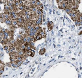 Immunohistochemistry Myosin VIIb Antibody - BSA Free