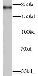 Western Blot: MYO16 Antibody - BSA Free [NBP3-46971] - Human brain tissue were subjected to SDS PAGE followed by western blot with (MYO16 antibody) at dilution of 1:500