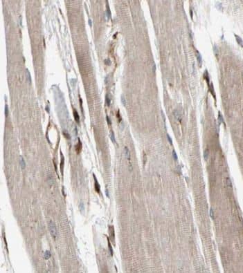 Immunohistochemistry: Fast skeletal myosin light chain 2 Antibody - BSA Free [NBP3-46972] - Immunohistochemistry of paraffin-embedded human skeletal muscle tissue slide using (Fast skeletal myosin light chain 2 Antibody) at dilution of 1:50