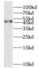 Western Blot: MYLK4 Antibody - BSA Free [NBP3-46973] - L02 cells were subjected to SDS PAGE followed by western blot with (MYLK4 Antibody) at dilution of 1:1000