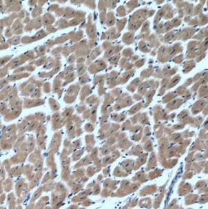 Immunohistochemistry: MYLK4 Antibody - BSA Free [NBP3-46973] - Immunohistochemistry of paraffin-embedded human heart tissue slide using (MYLK4 Antibody) at dilution of 1:200