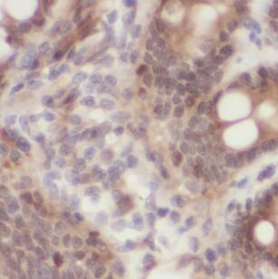 Immunohistochemistry: MYLK3 Antibody - BSA Free [NBP3-46974] - Immunohistochemistry of paraffin-embedded human colon using (MYLK3 antibody) at dilution of 1:100