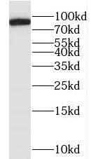Western Blot: MYLK3 Antibody - BSA Free [NBP3-46974] - Human heart tissue were subjected to SDS PAGE followed by western blot with (MYLK3 antibody) at dilution of 1:500