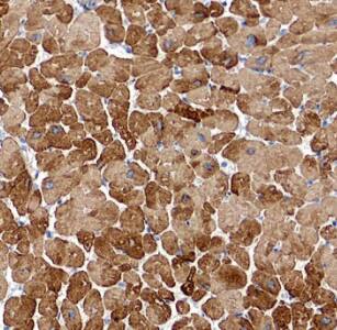 Immunohistochemistry: MYL7 Antibody - BSA Free [NBP3-46976] - Immunohistochemistry of paraffin-embedded human heart using (MYL7 antibody) at dilution of 1:100