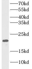Western Blot: MYL4 Antibody - BSA Free [NBP3-46978] - Human liver tissue were subjected to SDS PAGE followed by western blot with (MYL4 antibody) at dilution of 1:1000