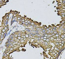 Immunohistochemistry: Fast skeletal myosin light chain 1 Antibody - BSA Free [NBP3-46980] - Immunohistochemistry of paraffin-embedded human human prostate using (Fast skeletal myosin light chain 1 antibody) at dilution of 1:100