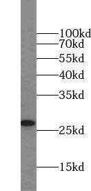 Western Blot: Fast skeletal myosin light chain 1 Antibody - BSA Free [NBP3-46980] - Mouse heart tissue were subjected to SDS PAGE followed by western blot with (Fast skeletal myosin light chain 1 antibody) at dilution of 1:1000