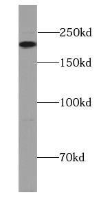 Western Blot: MYH4 Antibody - BSA Free [NBP3-46981] - Human skeletal muscle tissue were subjected to SDS PAGE followed by western blot with (MYH4 Antibody) at dilution of 1:500