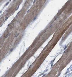 Immunohistochemistry: MYH4 Antibody - BSA Free [NBP3-46981] - Immunohistochemistry of paraffin-embedded human skeletal muscle tissue slide using (MYH4 Antibody) at dilution of 1:50