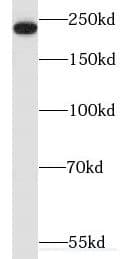 Western Blot: Myosin heavy chain 14 Antibody - BSA Free [NBP3-46983] - COLO 320 cells were subjected to SDS PAGE followed by western blot with (Myosin heavy chain 14 antibody) at dilution of 1:800