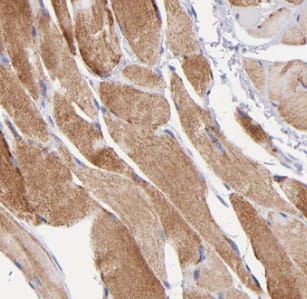 Immunohistochemistry: Myosin Heavy Chain 1 Antibody - BSA Free [NBP3-46984] - Immunohistochemistry of paraffin-embedded human skeletal muscle tissue slide using (Myosin Heavy Chain 1 Antibody) at dilution of 1:50