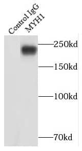 Immunoprecipitation: Myosin Heavy Chain 1 Antibody - BSA Free [NBP3-46984] - IP Result of anti-Myosin Heavy Chain 1 (IP:, 5ug; Detection: 1:1000) with mouse skeletal muscle tissue lysate 4000ug.