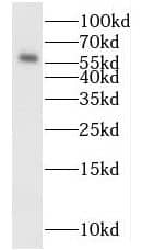 Western Blot: MYEOV Antibody - BSA Free [NBP3-46986] - SGC-7901 cells were subjected to SDS PAGE followed by western blot with (MYEOV antibody) at dilution of 1:400