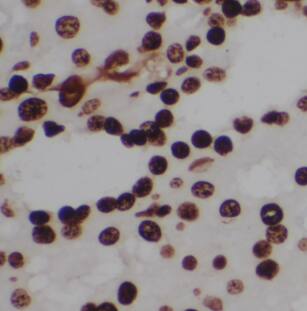 Immunohistochemistry: MYH Antibody - BSA Free [NBP3-46990] - Immunohistochemistry of paraffin-embedded human kidney slide using (MYH Antibody) at dilution of 1:50
