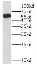 Western Blot: MYH Antibody - BSA Free [NBP3-46990] - HeLa cells were subjected to SDS PAGE followed by western blot with (MYH antibody) at dilution of 1:500