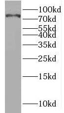 Western Blot: Mucolipin 3 Antibody - BSA Free [NBP3-46994] - A375 cells were subjected to SDS PAGE followed by western blot with (Mucolipin 3 antibody) at dilution of 1:400